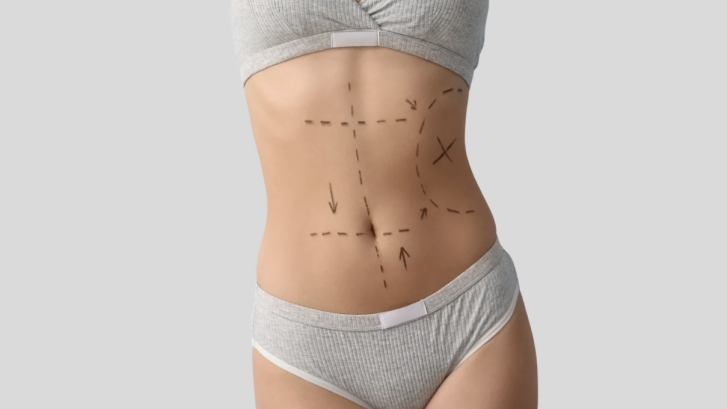 Top Clinic for Affordable Liposuction Near Calvert County Maryland
